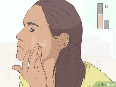 Image titled Get Rid of Acne Scars at Home Without Chemicals Step 8