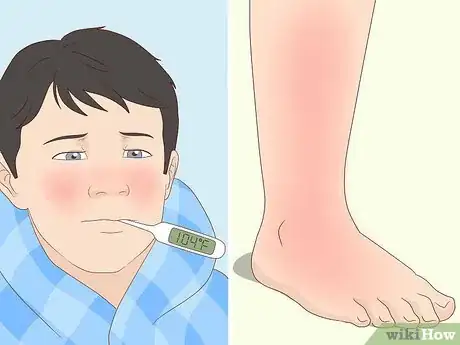 Image titled Diagnose Infective Endocarditis Step 5