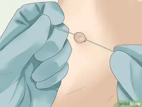 Image titled Get Rid of Skin Tags Step 5
