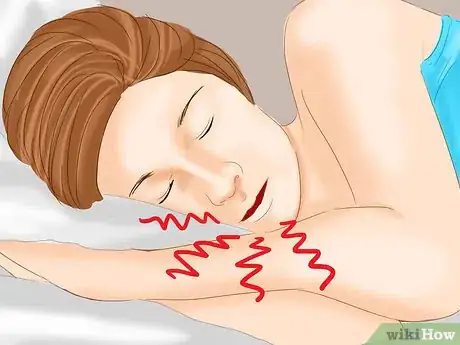 Image titled Stop Snoring Using Medical Devices Step 9