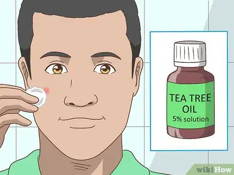 Image titled Get Rid of a Pimple Step 10