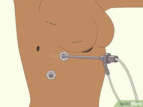 Image titled Diagnose Lung Problems Step 10