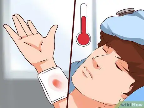 Image titled Clean a Cardiac Catheterization Site Step 11