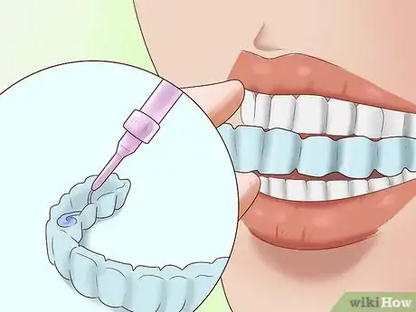 Image titled Have the Perfect Smile Step 11