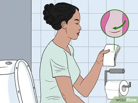 Image titled Treat Bacterial Vaginosis Naturally Step 12