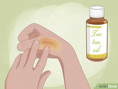 Image titled Use Herbs to Heal Step 2