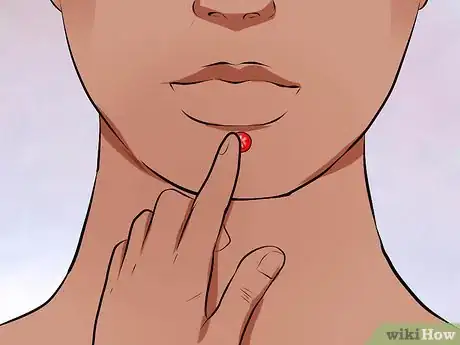 Image titled Make a Fake Lip Stud Step 7