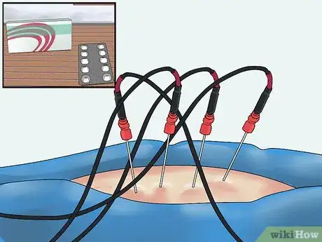 Image titled Get Rid of Uterine Fibroid Pain Step 19