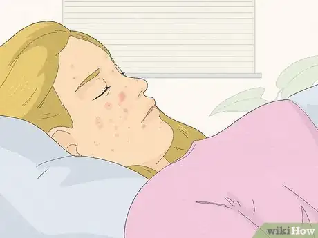 Image titled Be Confident If You Have Acne Step 16