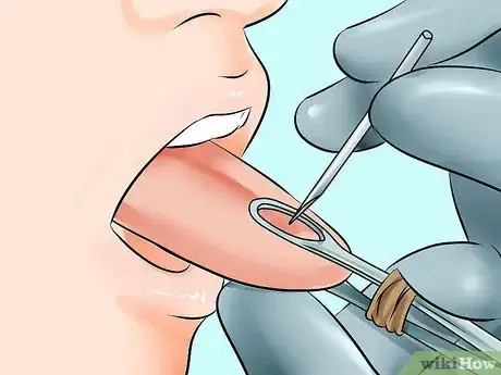 Image titled Pierce Your Own Tongue Step 8