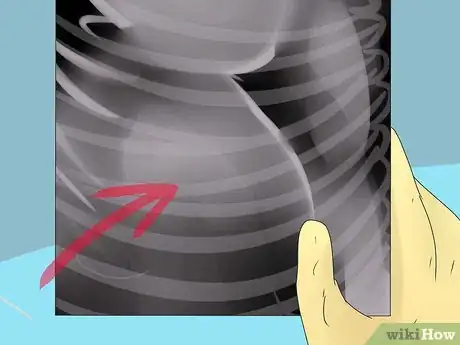 Image titled Diagnose a Cat Cough Step 11