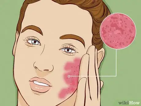 Image titled What Causes Skin to Be Sensitive Step 2