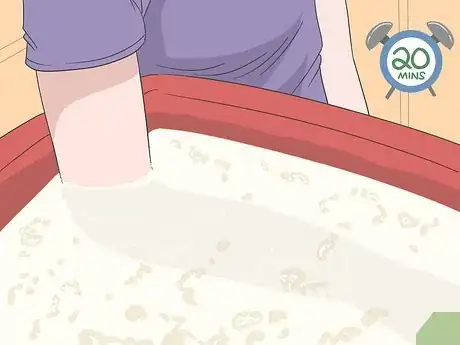 Image titled Stop Scabies Itching Step 4