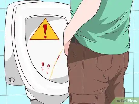 Image titled Know if You Have Epididymitis Step 3