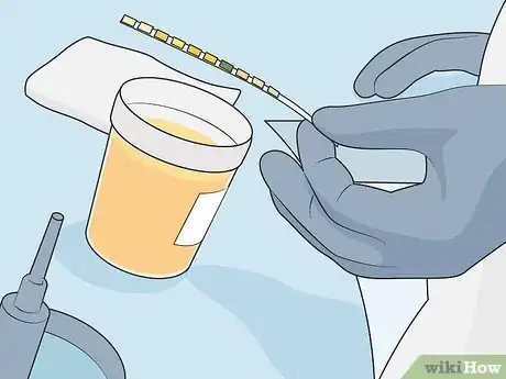 Image titled Treat Minimal Change Disease Step 03