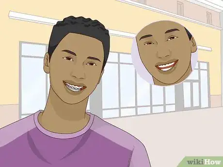 Image titled Wear Braces With Confidence and Style Step 7