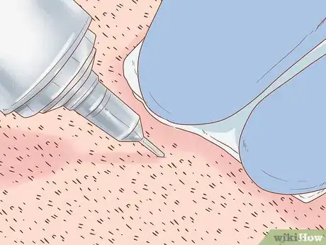 Image titled Stop Hormonal Hair Loss Step 8