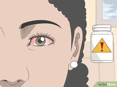 Image titled Treat Eye Sunburn Step 3
