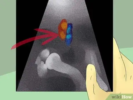 Image titled Diagnose a Cat Cough Step 16