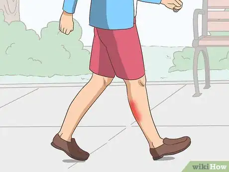 Image titled Lessen the Pain when You Get a Cramp Step 3