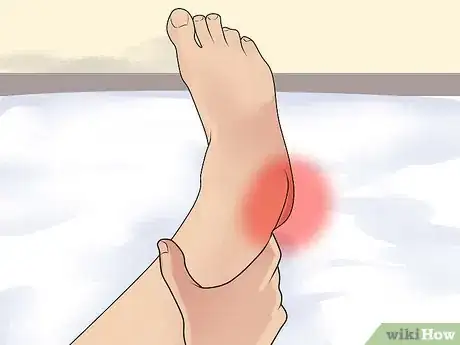 Image titled Diagnose Heel Spurs Step 1