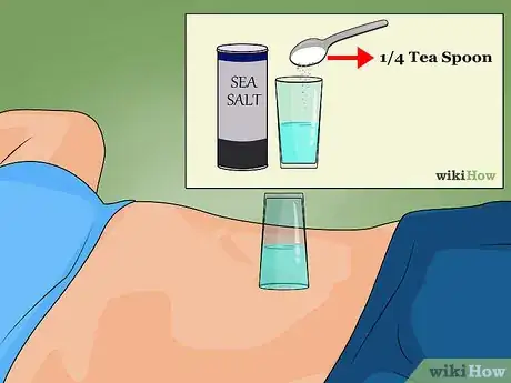 Image titled Care for a New Navel Piercing Step 4