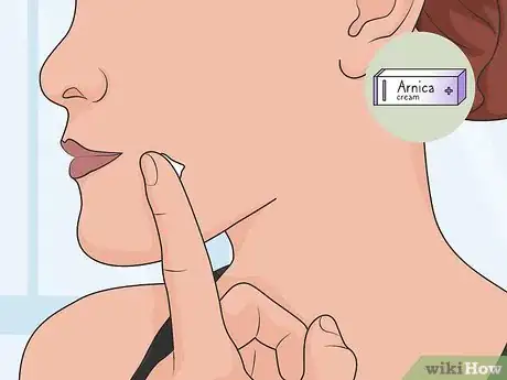 Image titled Use Arnica for Natural Remedies Step 03
