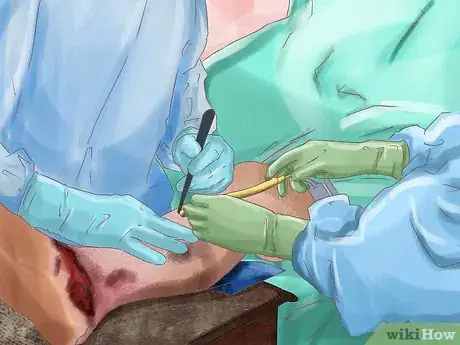 Image titled Treat Rickets Step 14