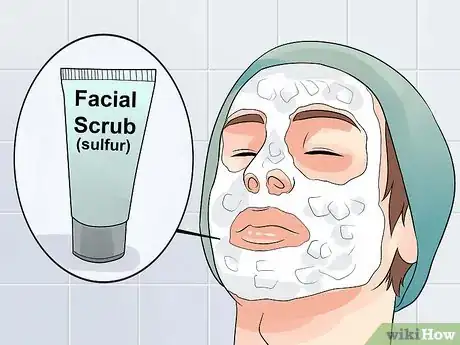 Image titled Clear Mild Acne Fast Step 4