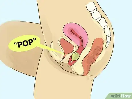 Image titled Use a Menstrual Cup Step 9