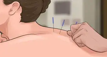 Choose an Acupuncturist