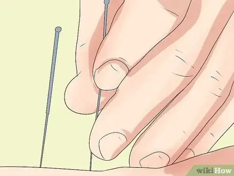 Image titled Manage Multiple Myeloma Pain Step 14