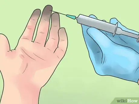 Image titled Heal Skin Damage from Frostbite Step 10