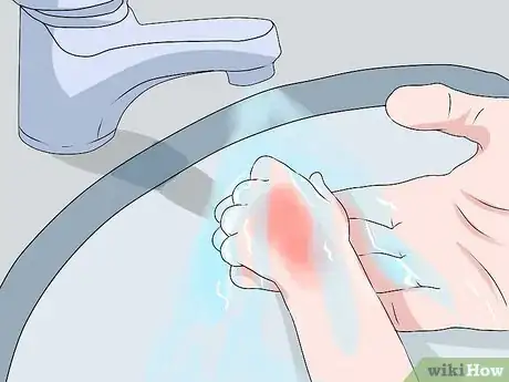 Image titled Treat Burns in Infants Step 3