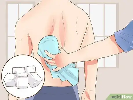 Image titled Use Acupressure for Back Pain Step 8