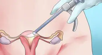 Treat Secondary Dysmenorrhea