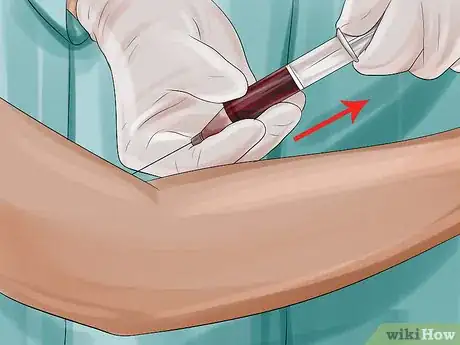 Image titled Diagnose Vitiligo Step 7