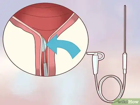 Image titled 7308742 11