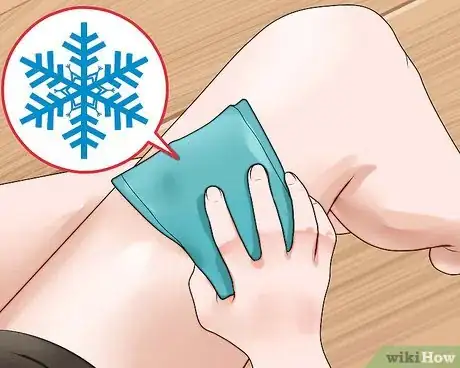 Image titled Reduce Edema During Pregnancy Step 8