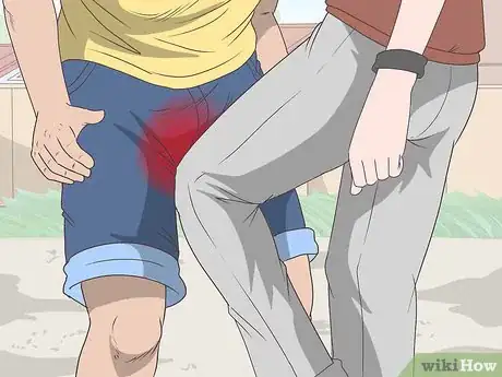 Image titled Know if You Have Epididymitis Step 9