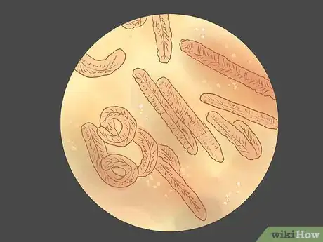 Image titled Recognize Marburg Hemorrhagic Fever Symptoms Step 11