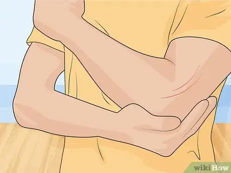 Image titled Treat a Vitamin A Deficiency Step 09