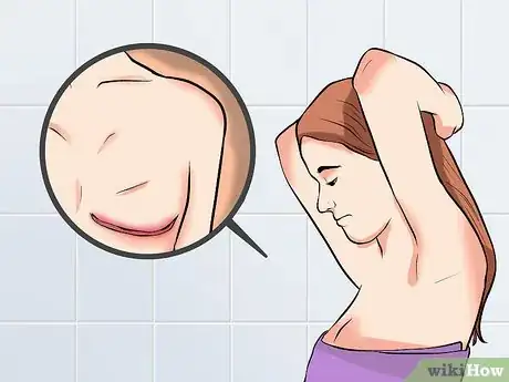 Image titled Know when to Call the Doctor After Mastectomy Surgery Step 12