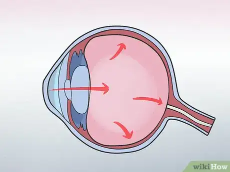 Image titled Diagnose Glaucoma in Poodles Step 10