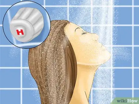 Image titled Treat Vibration Induced Hives Step 4