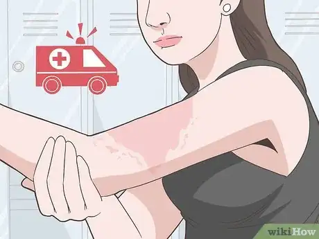 Image titled Take Benadryl Step 11