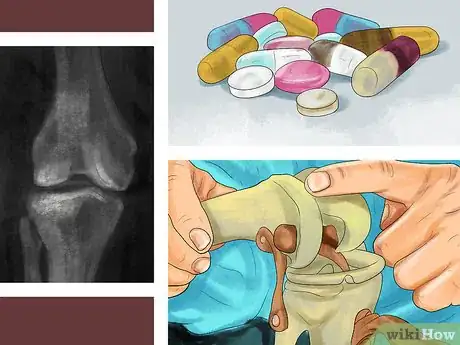Image titled Diagnose Bone Diseases in Growing Dogs Step 14