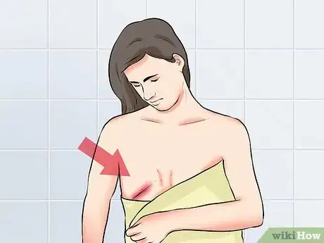 Image titled Know when to Call the Doctor After Mastectomy Surgery Step 14