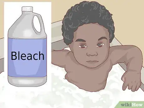 Image titled Treat Your Baby's Eczema Step 7