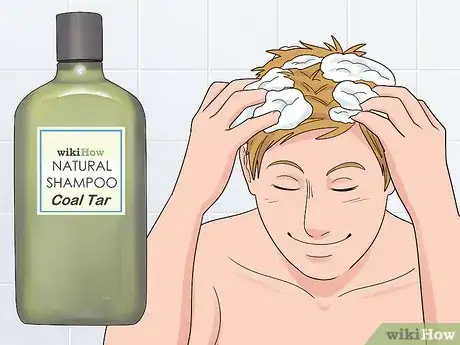 Image titled Prevent Psoriasis Step 5